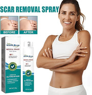 South Moon  Scar Spray