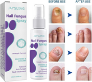 Extra Strong Nail Fungus Treatment Spray - 100ml