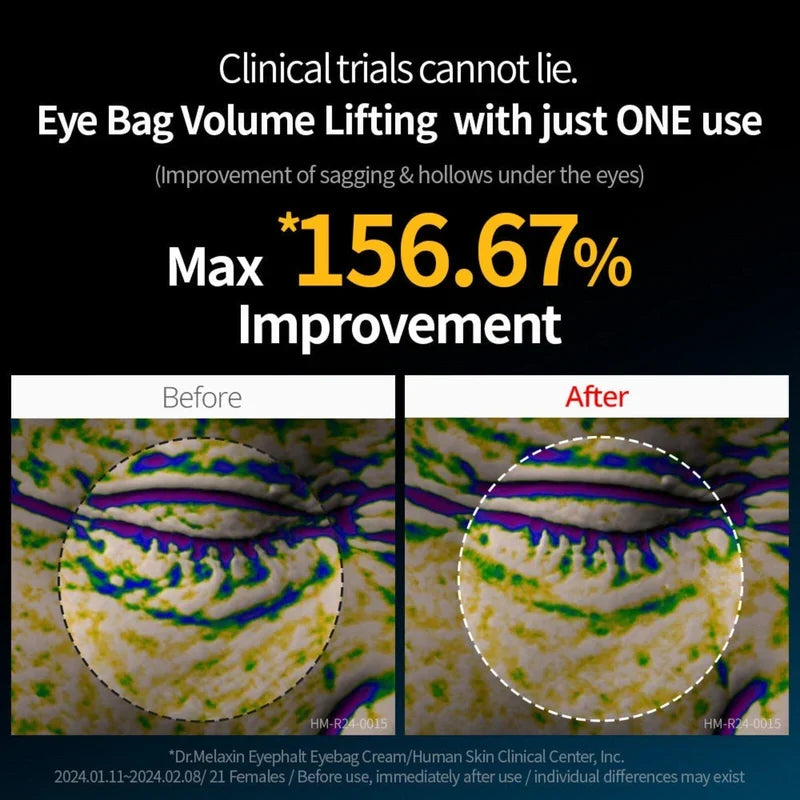Dr. Melaxin Eyephalt Eye Cream