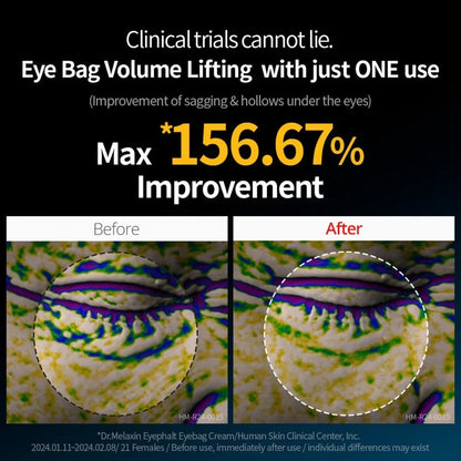 Dr. Melaxin Eyephalt Eye Cream