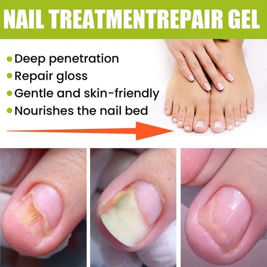 EELHOE Nail Treatment Repair Gel