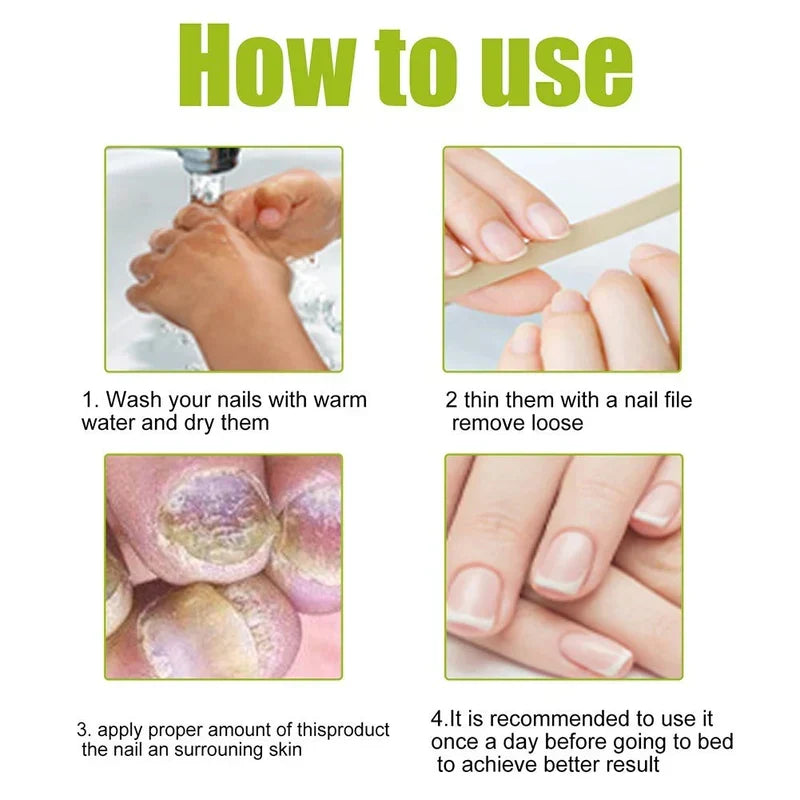 EELHOE Nail Treatment Repair Gel